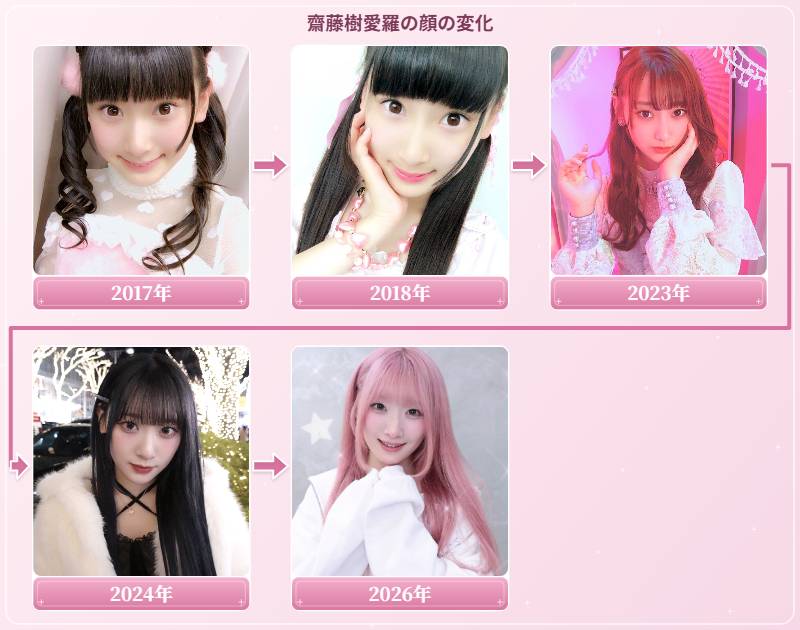 齋藤樹愛羅の顔の変化を2017年・2018年・2023年・2024年・2026年の写真で比較